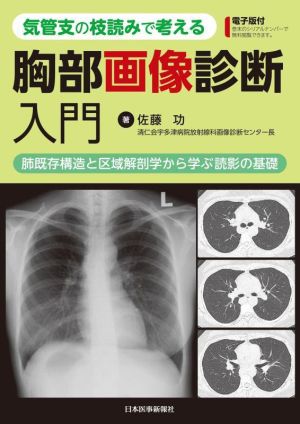 気管支の枝読みで考える 胸部画像診断入門 肺既存構造と区域解剖学から学ぶ読影の基礎