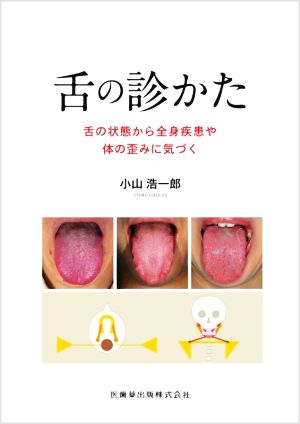 舌の診かた 舌の状態から全身疾患や体の歪みに気づく