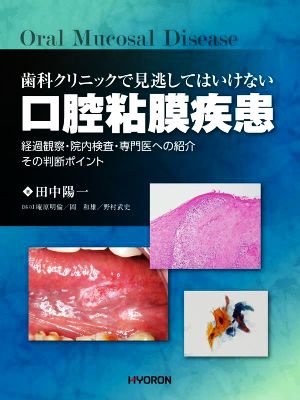 歯科クリニックで見逃してはいけない 口腔粘膜疾患 経過観察・院内検査・専門医への紹介その判断ポイント