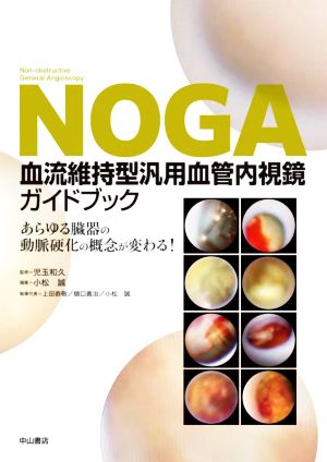 NOGA血流維持型汎用血管内視鏡ガイドブック あらゆる臓器の動脈硬化の概念が変わる！