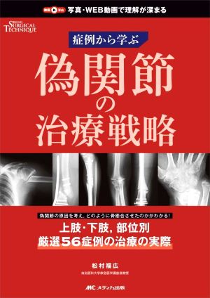 偽関節の治療戦略 症例から学ぶ 整形外科サージカルテクニック別冊