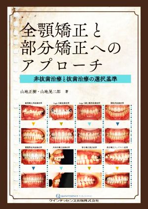 全顎矯正と部分矯正へのアプローチ 非抜歯治療と抜歯治療の選択基準