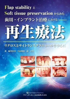 歯周・インプラント治療における再生療法リグロスとサイトランスグラニュールを中心に