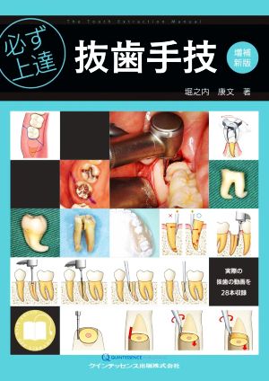 必ず上達 抜歯手技 増補新版 必ず上達シリーズ