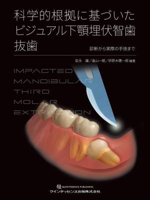 科学的根拠に基づいたビジュアル下顎埋伏智歯抜歯 診断から実際の手技まで