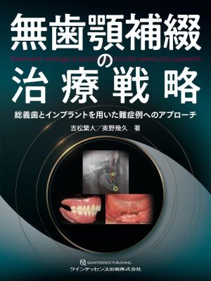 無歯顎補綴の治療戦略 総義歯とインプラントを用いた難症例へのアプローチ