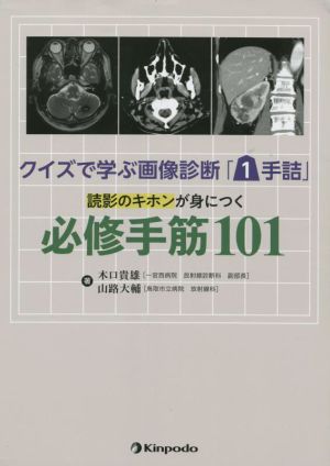 読影のキホンが身につく必修手筋101クイズで学ぶ画像診断「1手詰」