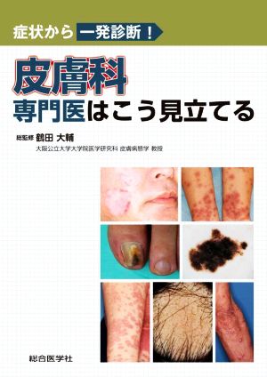 症状から一発診断！皮膚科専門医はこう見立てる