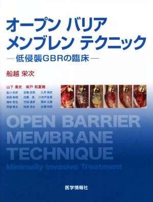 オープンバリアメンブレンテクニック低侵襲GBRの臨床