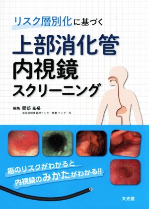 リスク層別化に基づく 上部消化管内視鏡スクリーニング