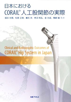 日本におけるCORAIL人工股関節の実際