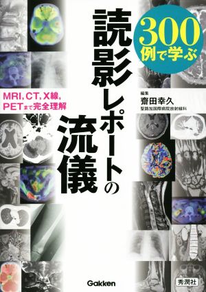 300例で学ぶ 読影レポートの流儀 MRI,CT,X線,PETまで完全理解