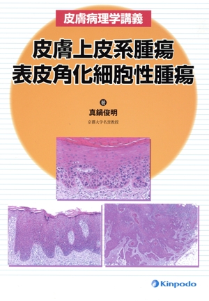 皮膚病理学講義 皮膚上皮系腫瘍 表皮角化細胞性腫瘍