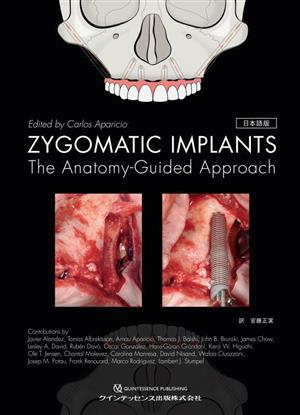 ZYGOMATIC IMPLANTS 日本語版The Anatomy-Guided Approach
