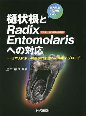 歯内療法Next Step 樋状根とRadix Entomolarisへの対応 日本人に多い解剖学的形態への臨床アプローチ