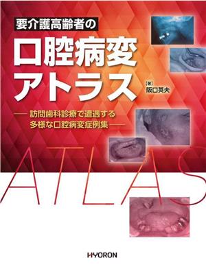 要介護高齢者の口腔病変アトラス 訪問歯科診療で遭遇する多様な口腔病変症例集