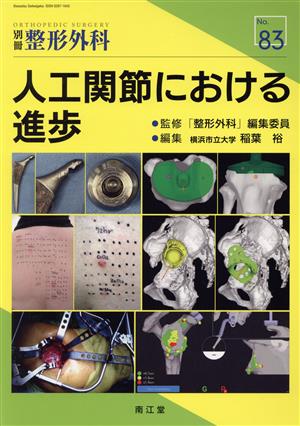 人工関節における進歩 別冊整形外科