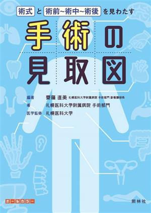 手術の見取図 術式と術前～術中～術後を見わたす