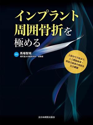 インプラント周囲骨折を極める 新品本・書籍 | ブックオフ公式