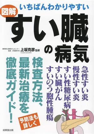 いちばんわかりやすい 図解 すい臓の病気