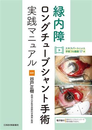 緑内障ロングチューブシャント手術実践マニュアル