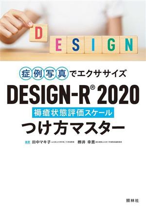 症例写真でエクササイズ DESIGN-R2020つけ方マスター 褥瘡状態評価スケール