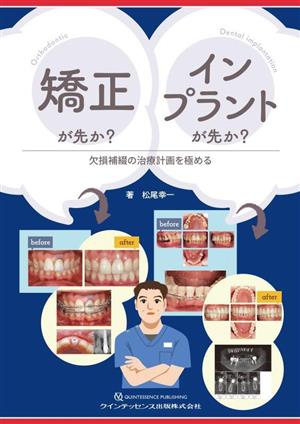 矯正が先か？インプラントが先か？ 欠損補綴の治療計画を極める