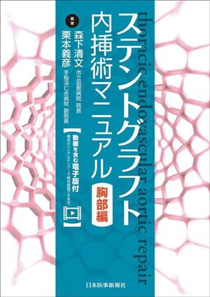 ステントグラフト内挿術マニュアル 胸部編