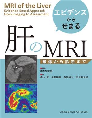 エビデンスからせまる 肝のMRI 撮像から診断まで