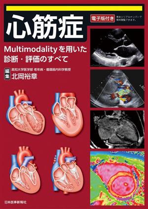 心筋症 Multimodalityを用いた診断・評価のすべて