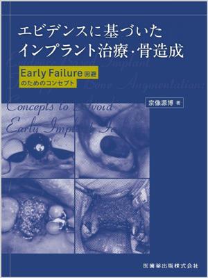 エビデンスに基づいたインプラント治療・骨造成 Early Failure回避のためのコンセプト