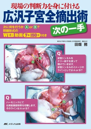 広汎子宮全摘出術 次の一手現場の判断力を身に付ける