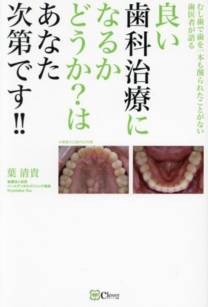 良い歯科治療になるかどうか？はあなた次第です!! むし歯で歯を一本も削られたことがない歯医者が語る