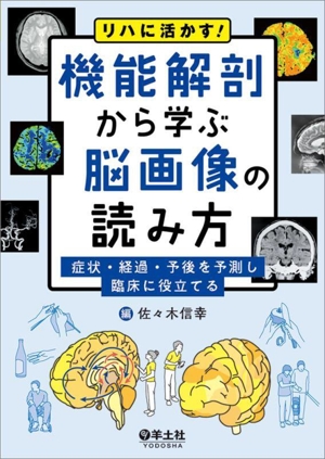 リハに活かす！機能解剖から学ぶ脳画像の読み方 症状・経過・予後を予測し臨床に役立てる