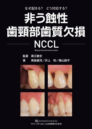 非う蝕性歯頸部歯質欠損 NCCL なぜ起きる？どう対応する？