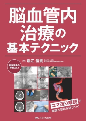 脳血管内治療の基本テクニック コマ送り解説で知識と技術が結びつく