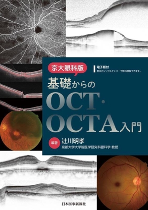 京大眼科版 基礎からのOCT・OCTA入門