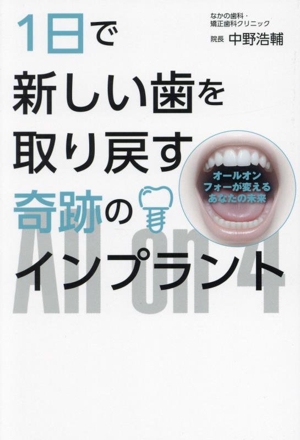 1日で新しい歯を取り戻す奇跡のインプラント オールオンフォーが変えるあなたの未来