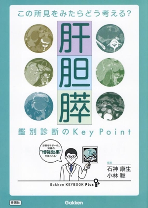 この所見をみたらどう考える？ 肝胆膵 鑑別診断のKey Point Gakken KEYBOOK Plus