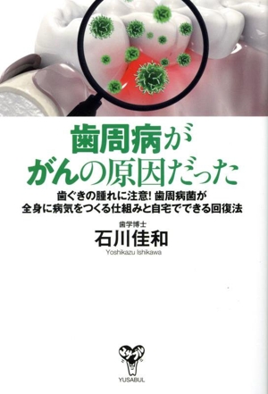 歯周病ががんの原因だった 歯ぐきの腫れに注意！歯周病菌が全身に病気をつくる仕組みと自宅でできる回復法