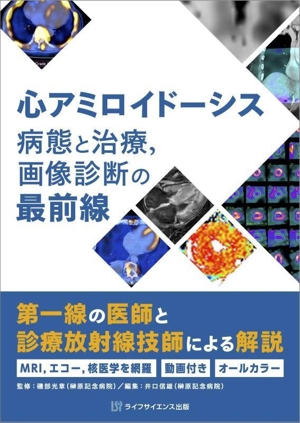 心アミロイドーシス 病態と治療,画像診断の最前線