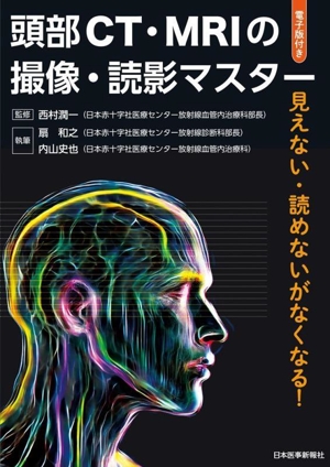 頭部CT・MRIの撮像・読影マスター 見えない・読めないがなくなる！