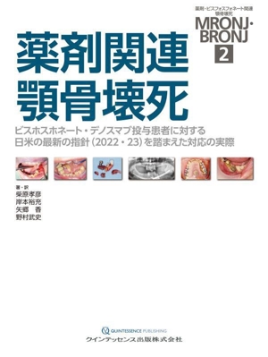 薬剤関連顎骨壊死 ビスホスホネート・デノスマブ投与患者に対する日米の最新の指針(2022・23)を踏まえた対応の実際 薬剤・ビスフォスフォネート関連顎骨壊死MRONJ・BRONJ2