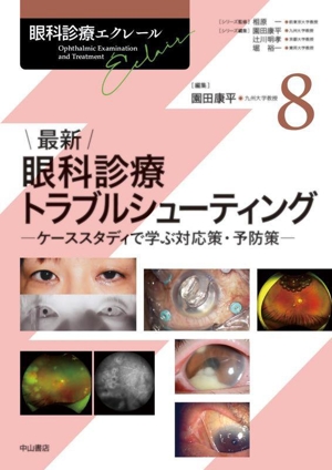 最新 眼科診療トラブルシューティング ケーススタディで学ぶ対応策・予防策 眼科診療エクレール8