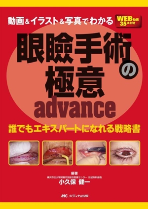 動画&イラスト&写真でわかる 眼瞼手術の極意 advance 誰でもエキスパートになれる戦略書