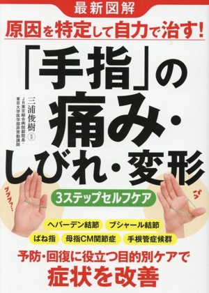 最新図解 原因を特定して自力で治す！「手指」の痛み・しびれ・変形 3ステップセルフケア