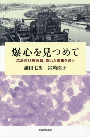 爆心を見つめて 広島の88歳医師、隠れた真相を追う