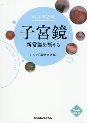 子宮鏡 新常識を極める 改訂第2版
