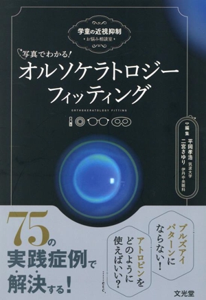 写真でわかる！オルソケラトロジーフィッティング 学童の近視抑制 お悩み相談室