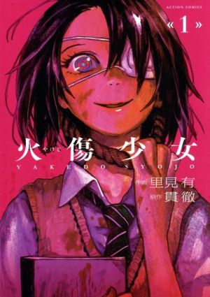 【コミック】火傷少女(全4巻)セット